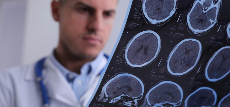 Epilepsy and seizure management at NeuMed Clinics Hyderabad